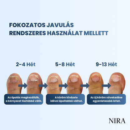 NIRA Éjszakai Tapasz Gombás Körömre (Természetes megoldás körömgombára)